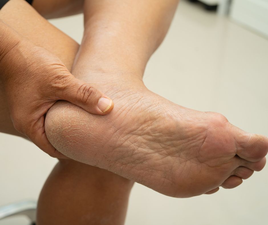 When to Refer Heel Pain: Differentiating Plantar Fasciitis and Achilles Tendinopathy
